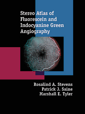 Stereo Atlas of FA & ICG Angiography